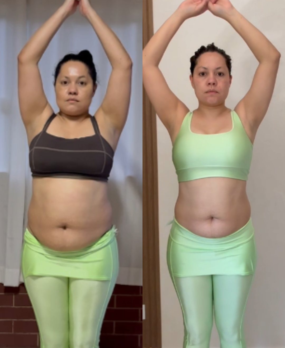 Antes e depois de Bruna Moraes: redução de 9 kg em 16 semanas com o uso de caneta emagrecedora